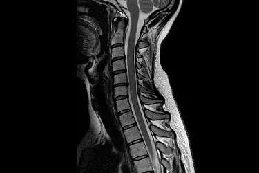 Best MRI Centre in Purnia, 1.5 Tesla MRI in Purnia, 3 Tesla MRI in Purnia, Lowest cost of MRI in Purnia, Breast MRI in Purnia, MR Angiography Test in Purnia, MR Spectroscopy in Purnia, MRI Brain in Purnia, MRI Knee Joint in Purnia, MRI Spine in Purnia, MRI Neck Vessels in Purnia, best diagnostic centre in Purnia, MRI Abdomen in Purnia, MRI Chest in Purnia, Contrast MRI in Purnia